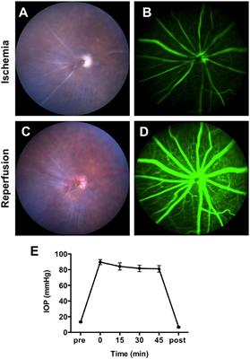 The Alternative Complement System Mediates Cell Death in Retinal Ischemia Reperfusion Injury